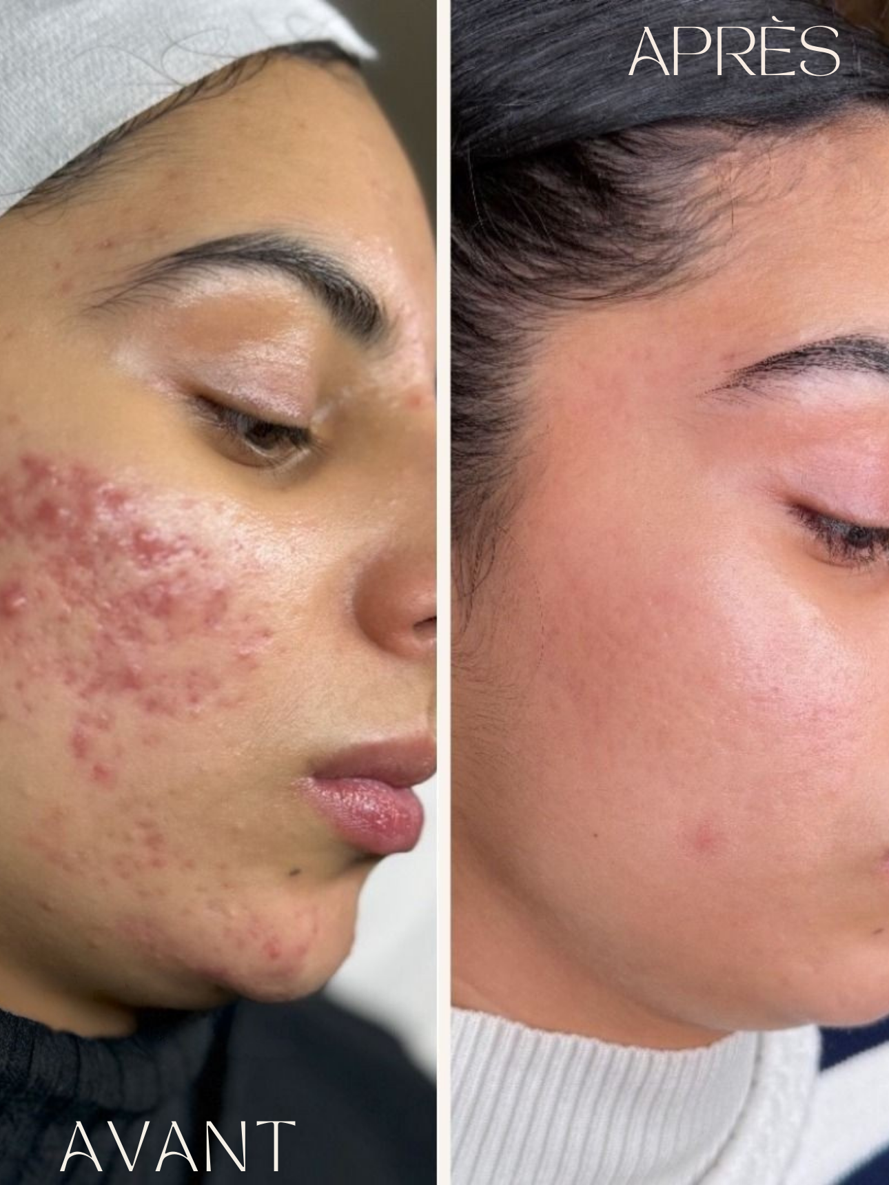 Purevya™ - Peau éclatante en 7 jours