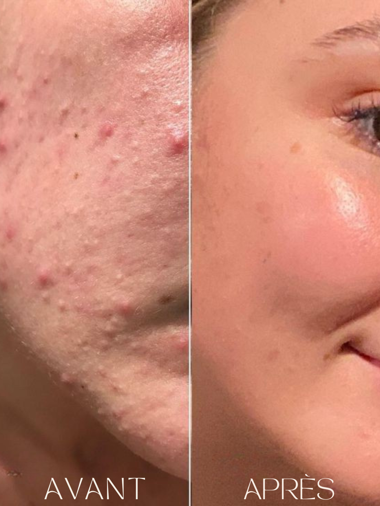 Purevya™ - Peau éclatante en 7 jours