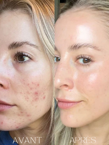 Purevya™ - Peau éclatante en 7 jours