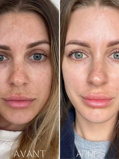 Purevya™ - Peau éclatante en 7 jours